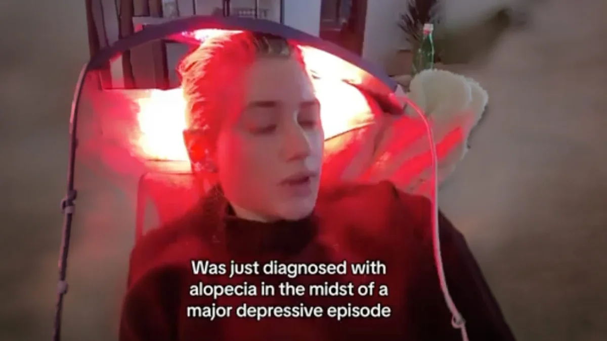 Lili Reinhart reclines under a curved red light therapy panel with her eyes closed, in a TikTok captioned with her alopecia diagnosis